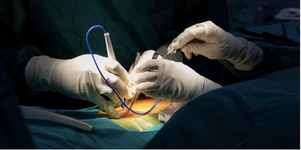 n to Consider Minimally Invasive Orthopaedic Procedures – Arthroscopy, Injections & Shockwave Therapy